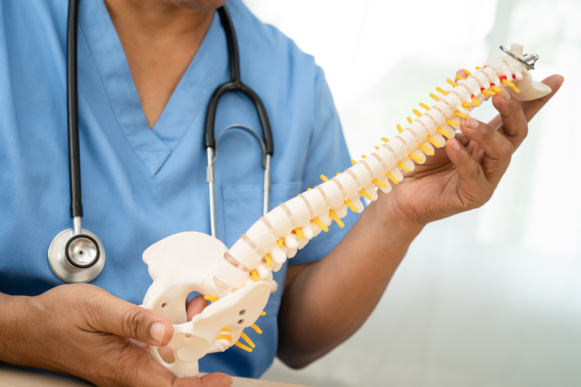 Asian doctor holding spinal nerve and bone model, Lumbar spine displaced herniated disc fragment