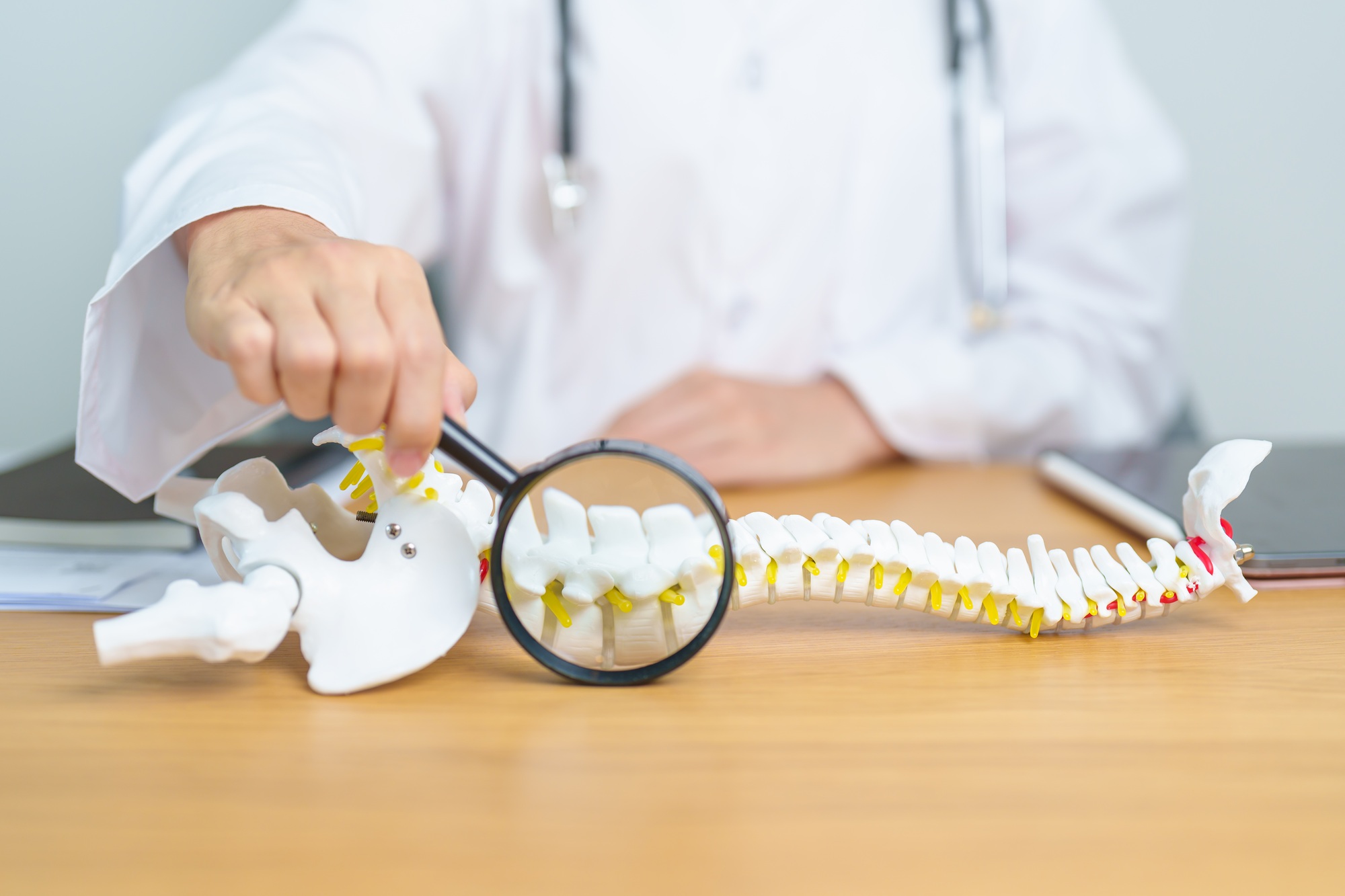 Doctor with human Spine anatomy model. Spinal Cord Disorder
