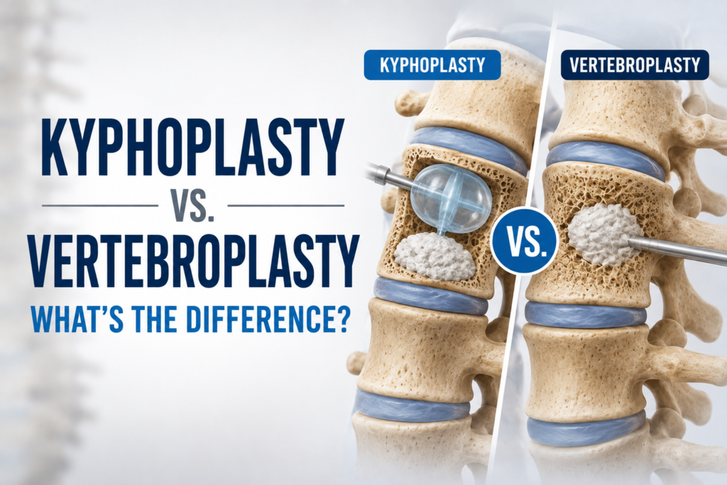 Kyphoplasty vs. Vertebroplasty: What’s the Difference?