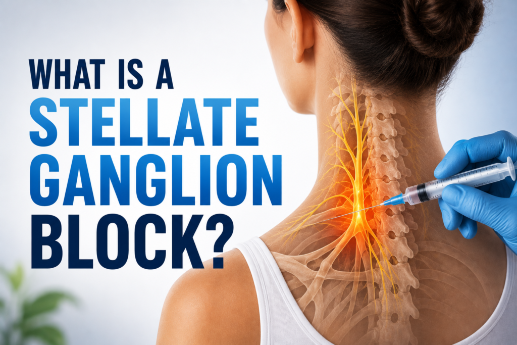 What Is a Stellate Ganglion Block?